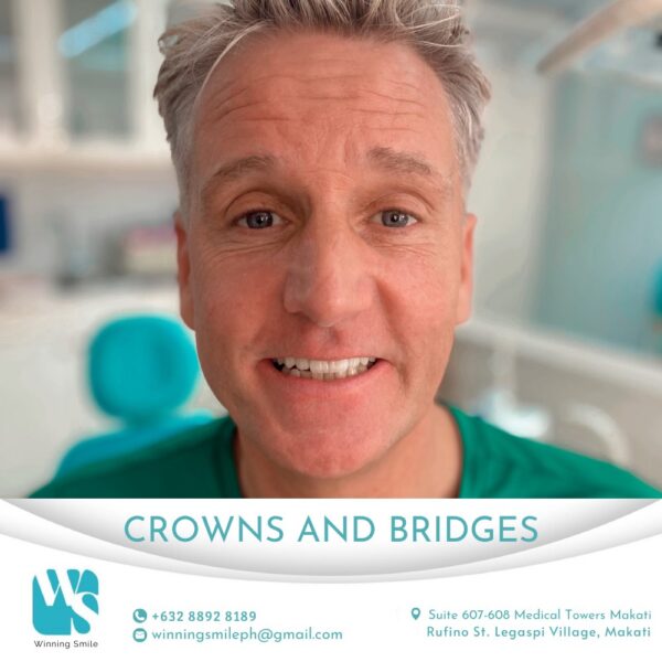 Cost of Dental Crowns in the Philippines Winning Smile Dental Clinic